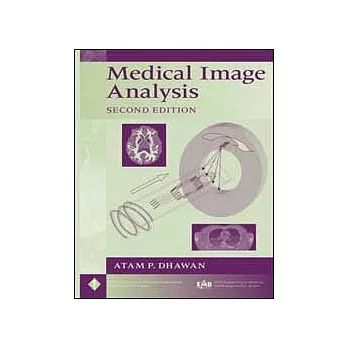 MEDICAL IMAGE ANALYSIS 2/E