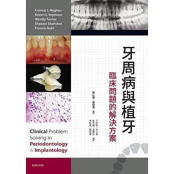 牙周病與植牙：臨床問題的解決方案