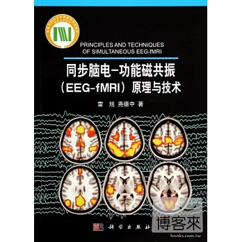 同步腦電:功能磁共振（EEG-fMRI）原理與技術