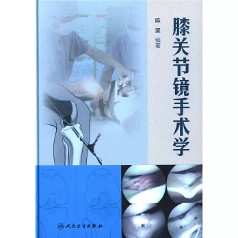 膝關節鏡手術學