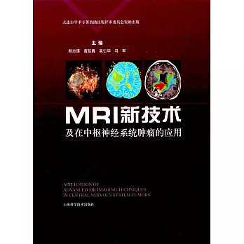 MRI新技術及在中樞神經系統腫瘤的應用