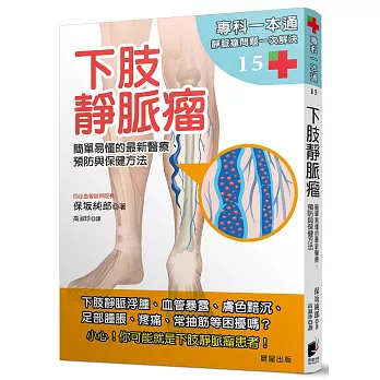 下肢靜脈瘤:簡單易懂的最新醫療、預防與保健方法