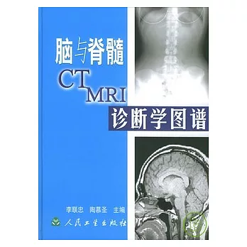 腦與脊髓CT、MRI診斷圖譜