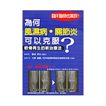 為何風濕病關節炎可以克服?-軟骨再生的新治療法