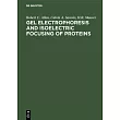 Gel Electrophoresis and Isoelectric Focusing of Proteins