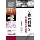 牙周病與植牙：臨床問題的解決方案