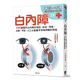 白內障：196篇關於白內障的病因、症狀、檢查、治療、手術、人工水晶體以及術後照護的問題