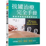 拔罐治療完全手冊：徹底消除肌肉與關節的疼痛