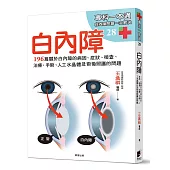 白內障：196篇關於白內障的病因、症狀、檢查、治療、手術、人工水晶體以及術後照護的問題