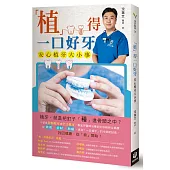 「植」得一口好牙：安心植牙大小事