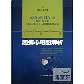起搏心電圖解析