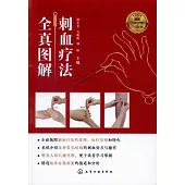 刺血療法全真圖解(贈送人體經絡穴位彩圖)