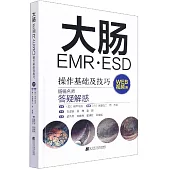 大腸EMR·ESD操作基礎及技巧(WEB視頻附)