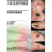 大原皮膚科圖譜：皮膚惡性腫瘤篇 (電子書)