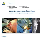 Osteotomies Around the Knee: Indications-Planning- Surgical Techniques Using Plate Fixators