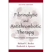 Fibrinolytic and Antithrombotic Therapy: Theory, Practice, and Management