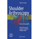 Shoulder Arthroscopy: How to Succeed!