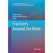 Fractures Around the Knee