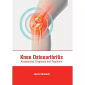 Knee Osteoarthritis: Assessment, Diagnosis and Treatment