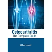 Osteoarthritis: The Complete Guide