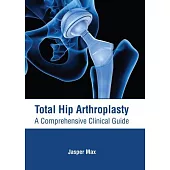Total Hip Arthroplasty: A Comprehensive Clinical Guide