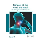 Cancers of the Head and Neck: From Diagnosis to Treatment