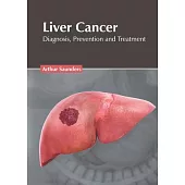 Liver Cancer: Diagnosis, Prevention and Treatment