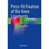 Press-Fit Fixation of the Knee Ligaments