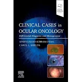 Clinical Cases in Ocular Oncology: Differential Diagnosis and Management