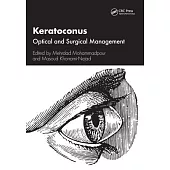 Keratoconus: Optical and Surgical Management