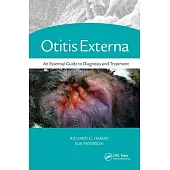 Otitis Externa: An Essential Guide to Diagnosis and Treatment