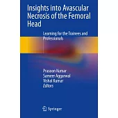 Insights Into Avascular Necrosis of the Femoral Head: Learning for the Trainees and Professionals