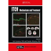 Itch: Mechanisms and Treatment