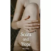 Scars and Hope