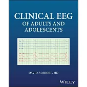Clinical Eeg of Adults and Adolescents