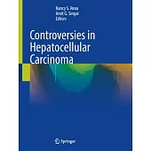 Controversies in Hepatocellular Carcinoma