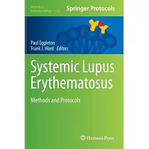 Systemic Lupus Erythematosus： Methods and Protocols