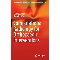 Computational Radiology for Orthopaedic Interventions