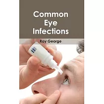 Common Eye Infections