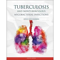 Tuberculosis and Nontuberculous Mycobacterial Infections