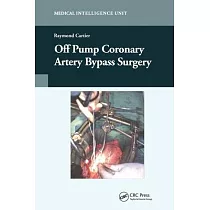 Off─Pump Coronary Artery Bypass Surgery