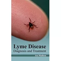 Lyme Disease： Diagnosis and Treatment