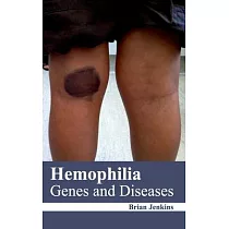 Hemophilia： Genes and Diseases