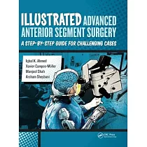 Illustrated Advanced Anterior Segment Surgery： A Step─By─Step Guide for Challenging Cases