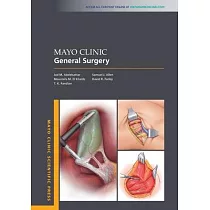Mayo Clinic General Surgery