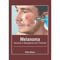 Melanoma： Advances in Management and Treatment