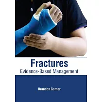 Fractures： Evidence─Based Management