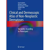 Clinical and Dermoscopic Atlas of Non─Neoplastic Dermatoses： Variability According to Phototypes