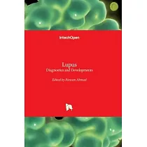 Lupus ─ Diagnostics and Developments： Diagnostics and Developments