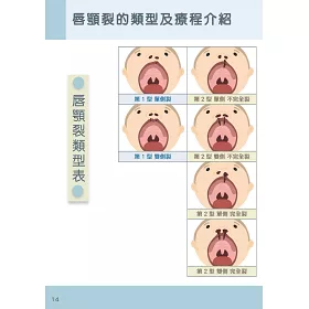 博客來 小兔兒要長大 唇顎裂療癒手冊